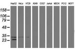 Western blot analysis of extracts (35 µg) from 9 different cell lines by using anti-GSTT2 monoclonal antibody.