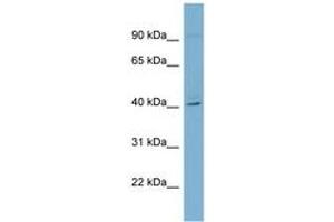 Image no. 1 for anti-Ret Finger Protein-Like 3 (RFPL3) (C-Term) antibody (ABIN6741947) (RFPL3 antibody  (C-Term))