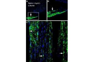 Expression of Periaxin in rat peripheral nerve - Immunohistochemical staining of free floating frozen rat peripheral nerve sections using Anti-Periaxin Antibody (ABIN7043432, ABIN7044712 and ABIN7044713), (#1:600). (Periaxin antibody  (Intracellular, N-Term))
