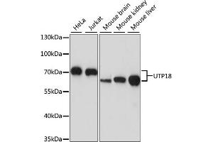 Western blot analysis of extracts of various cell lines, using UTP18 antibody (ABIN7271359) at 1:1000 dilution. (UTP18 antibody  (AA 70-260))