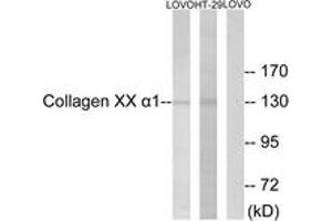 Western blot analysis of extracts from LOVO/HT-19 cells, using Collagen XX alpha1 Antibody. (COL20A1 antibody  (AA 1151-1200))