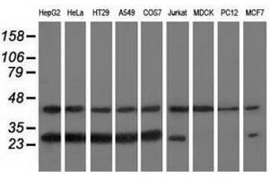 Image no. 2 for anti-RAB, Member of RAS Oncogene Family-Like 2A (RABL2A) antibody (ABIN1500577) (RABL2A antibody)