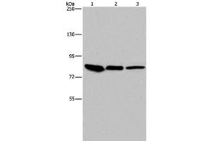 Western Blot analysis of Mouse skin tissue, HUVEC and Hela cell using Catenin gamma Polyclonal Antibody at dilution of 1:850 (JUP antibody)