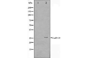 Western blot analysis on LOVO cell lysate using Claudin 10 Antibody,The lane on the left is treated with the antigen-specific peptide.