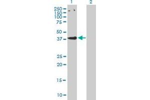 Western Blot analysis of CCBP2 expression in transfected 293T cell line by CCBP2 MaxPab polyclonal antibody. (CCBP2 antibody  (AA 1-384))