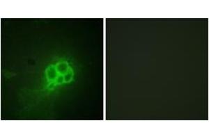 Immunofluorescence analysis of HuvEc cells, using Tryptophan Hydroxylase (Ab-260) Antibody. (Tryptophan Hydroxylase 1 antibody  (AA 231-280))