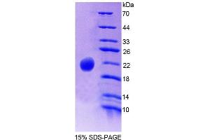 Image no. 1 for Phospholipase C beta 3, Phosphoinositide Specific (AA 318-468) protein (His tag) (ABIN6238757)