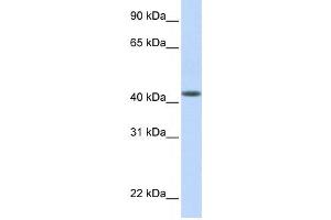 Western Blotting (WB) image for anti-DENN/MADD Domain Containing 1B (DENND1B) antibody (ABIN2459575) (DENND1B antibody)