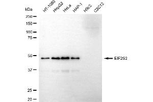 Western blotting analysis using EIF2S2 antibody (ABIN7798511).