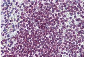 Human Spleen: Formalin-Fixed, Paraffin-Embedded (FFPE) (FOXO3 antibody  (AA 361-460))