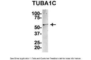 IP Suggested AntiTUBA1C Antibody Positive Control: NT2 CELL/BRAIN TISSUE (TUBA1C antibody  (C-Term))