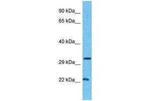 Host:  Rabbit  Target Name:  MINA  Sample Type:  Breast Tumor lysates  Antibody Dilution:  1. (MINA antibody  (C-Term))