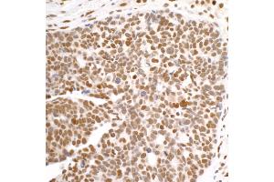 Immunohistochemistry (IHC) image for anti-DEAD (Asp-Glu-Ala-Asp) Box Polypeptide 1 (DDX1) (C-Term) antibody (ABIN7453882) (DDX1 antibody  (C-Term))