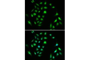 Immunofluorescence analysis of A549 cells using CHUK antibody.