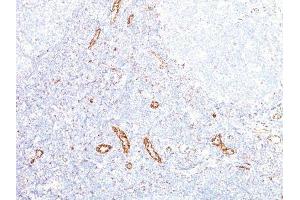 Image no. 1 for anti-Vascular Endothelial Growth Factor A (VEGFA) antibody (ABIN6168158) (VEGFA antibody)