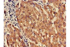 Immunohistochemistry of paraffin-embedded human liver tissue using ABIN7162462 at dilution of 1:100 (SLC1A3 antibody  (AA 7-151))