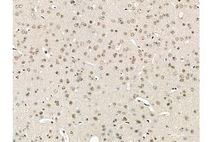 ABIN6264251 and ABIN6266824 at 1/100 staining Mouse brain tissue by IHC-P. (PKCB1 antibody  (Internal Region))