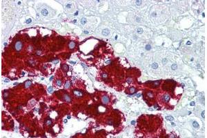 Human Adrenal: Formalin-Fixed, Paraffin-Embedded (FFPE) (Podoplanin antibody  (C-Term))