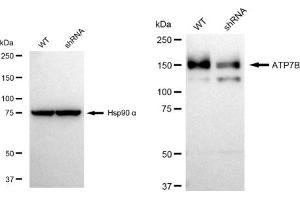 Western blotting analysis using ATP7B antibody (ABIN7797696). (Recombinant ATP7B antibody)