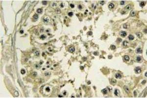 Immunohistochemistry analyzes of Hrs antibody in paraffin-embedded Human testis tissue. (HGS antibody)