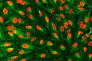 IF analysis of SART1 using anti-SART1 antibody (ABIN7599884) and anti-Beta Tubulin antibody (ABIN7602743). (SART1 antibody  (AA 125-800))