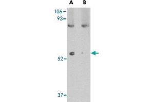 Western blot analysis of LGI1 in mouse brain tissue lysate with LGI1 polyclonal antibody  at 1 ug/mL in (A) the absence and (B) the presence of blocking peptide. (LGI1 antibody  (N-Term))