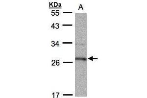 WB Image Sample (30μg whole cell lysate) A:Raji , 12% SDS PAGE antibody diluted at 1:1000 (HPGD antibody  (C-Term))