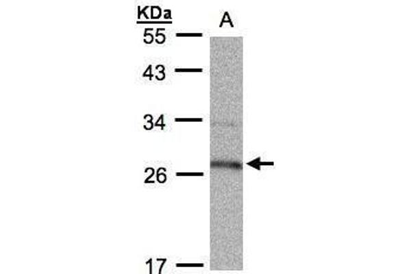 HPGD antibody  (C-Term)