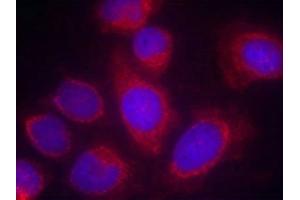 Immunofluorescence staining of methanol-fixed Hela cells using CPI17a(Ab-38) Antibody. (CPI-17 antibody)