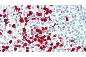 Immunohistochemistry of paraffin-embedded Spleen tissue using S100A12 Polyclonal Antibody at dilution of 1:60. (S100A12 antibody)