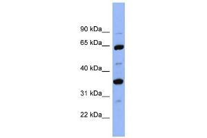 WB Suggested Anti-SERPINC1 Antibody Titration:  0. (SERPINC1 antibody  (Middle Region))