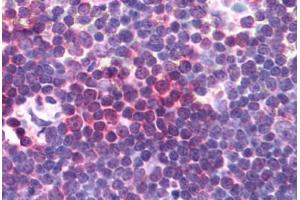 Human Thymus (formalin-fixed, paraffin-embedded) stained with AURKA antibody ABIN292641 at 10 ug/ml followed by biotinylated anti-goat IgG secondary antibody ABIN481715, alkaline phosphatase-streptavidin and chromogen. (Aurora A antibody  (AA 394-403))