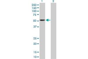 Western Blot analysis of LEPRE1 expression in transfected 293T cell line by LEPRE1 MaxPab polyclonal antibody. (LEPRE1 antibody  (AA 1-390))