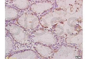 YES1 antibody  (pTyr426)