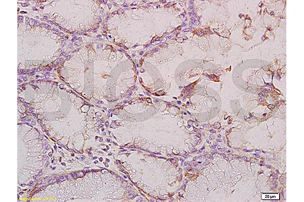 YES1 antibody  (pTyr426)