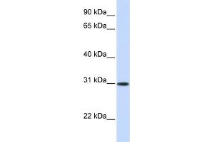WB Suggested Anti-ATF5 Antibody Titration: 0. (ATF5 antibody  (Middle Region))