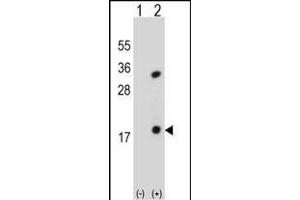 Western blot analysis of PLA2G1B (arrow) using rabbit polyclonal PLA2G1B Antibody (C-term) (ABIN651072 and ABIN2840059). (PLA2G1B antibody  (C-Term))