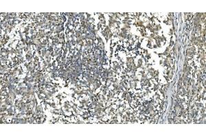 IHC analysis of LSM7 using anti-LSM7 antibody (ABIN7598937). (LSM7 antibody  (AA 1-103))