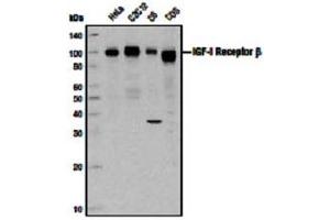Image no. 3 for anti-Insulin-Like Growth Factor 1 Receptor (IGF1R) (C-Term) antibody (ABIN228595) (IGF1R antibody  (C-Term))