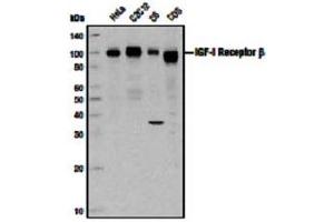 Image no. 3 for anti-Insulin-Like Growth Factor 1 Receptor (IGF1R) (C-Term) antibody (ABIN228595)