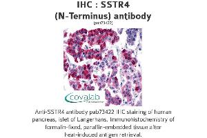 Image no. 1 for anti-Somatostatin Receptor 4 (SSTR4) (Extracellular Domain), (N-Term) antibody (ABIN1739674)