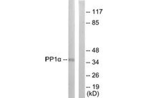 Western Blotting (WB) image for anti-Protein Phosphatase 1, Catalytic Subunit, alpha Isoform (PPP1CA) (AA 281-330), (pThr320) antibody (ABIN1531470) (PPP1CA antibody  (pThr320))