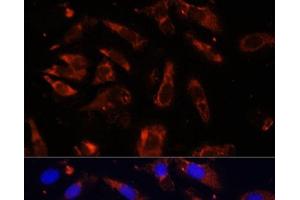 Immunofluorescence analysis of U-2OS cells using MCTS1 Polyclonal Antibody at dilution of 1:100 (40x lens). (MCTS1 antibody)