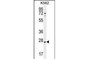 hCG_2024410 Antibody (C-term) (ABIN654993 and ABIN2850479) western blot analysis in K562 cell line lysates (35 μg/lane). (hCG_2024410 (AA 187-215), (C-Term) antibody)