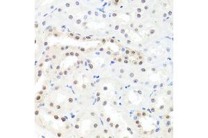 Immunohistochemistry of paraffin-embedded rat kidney using HNRNPCL1 antibody (ABIN5995850) at dilution of 1/100 (40x lens). (HNRNPCL1 antibody)