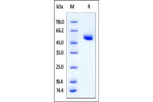 Rat CTLA-4, Fc Tag on SDS-PAGE under reducing (R) condition. (CTLA4 Protein (AA 38-161) (Fc Tag))