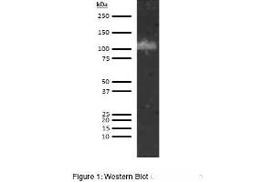 Western Blotting (WB) image for anti-ADAM Metallopeptidase with Thrombospondin Type 1 Motif, 13 (ADAMTS13) antibody (ABIN5566846) (ADAMTS13 antibody)