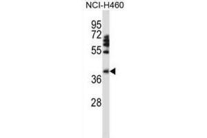 Western Blotting (WB) image for anti-Forkhead Box D1 (FOXD1) antibody (ABIN2997954) (FOXD1 antibody)