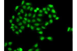 Immunofluorescence analysis of A549 cells using PHF11 antibody. (PHF11 antibody)