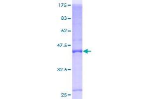 BTG1 Protein (AA 1-171) (GST tag)
